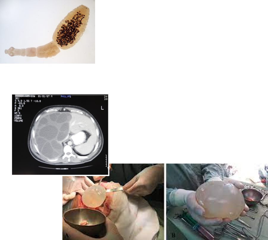 <p>elevated transferrin sat</p><p><strong>C282Y homozygous </strong>(genetic testing) </p>