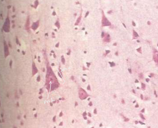 <p>lacks true morphology </p>
