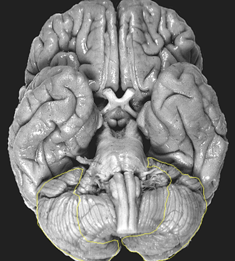 <p>What is the area highlighted called?</p>