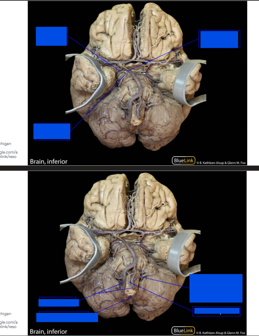 <p>Label the brain</p>
