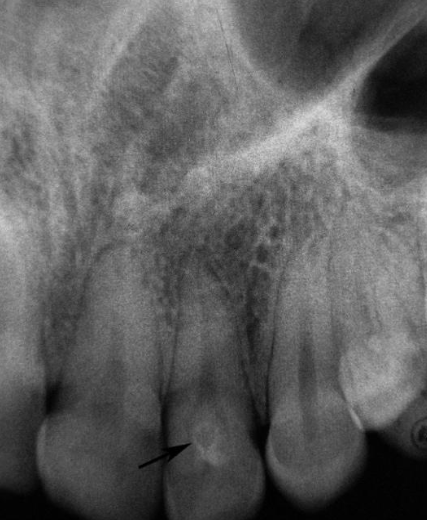 <p>what is the dx?</p>