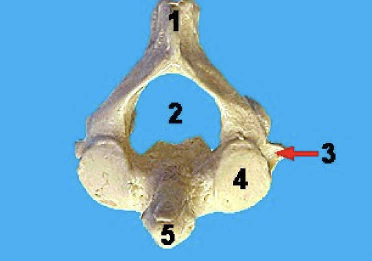 <p>what vertebra is this and what view</p>