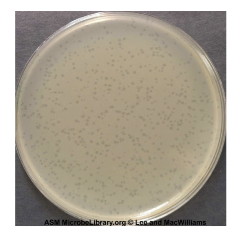 <p>what are the clear spots and what are they caused by</p>