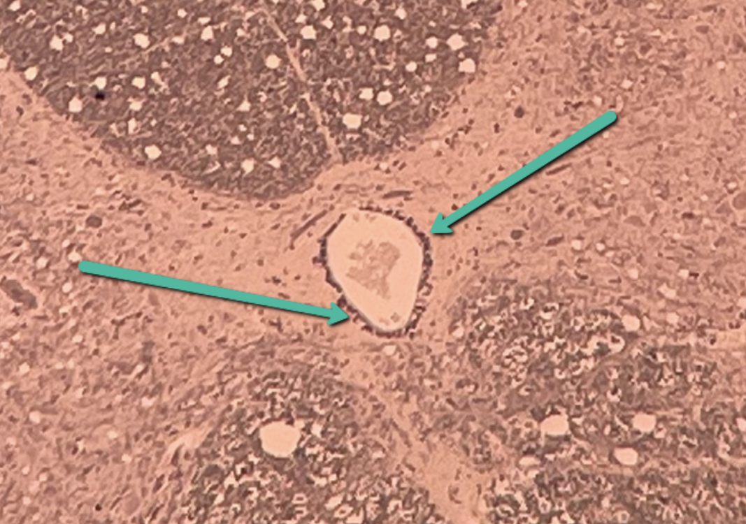 <p>Identify the small dark cells surrounding the opening indicated by the pointers.</p>