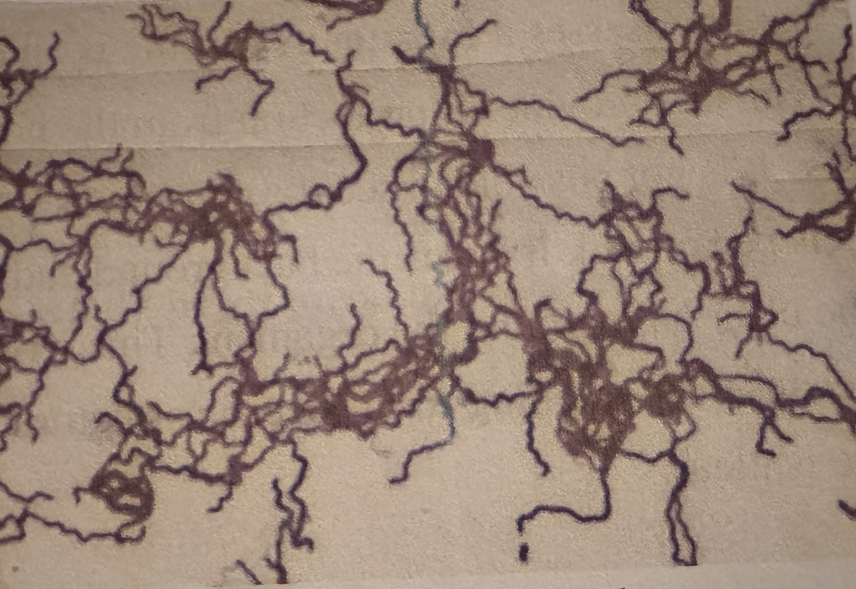 <p>Treponema pallidum </p>