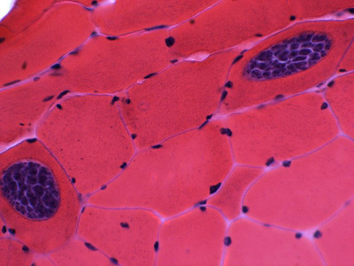 <p>Coccidia in muscle tissue? </p>