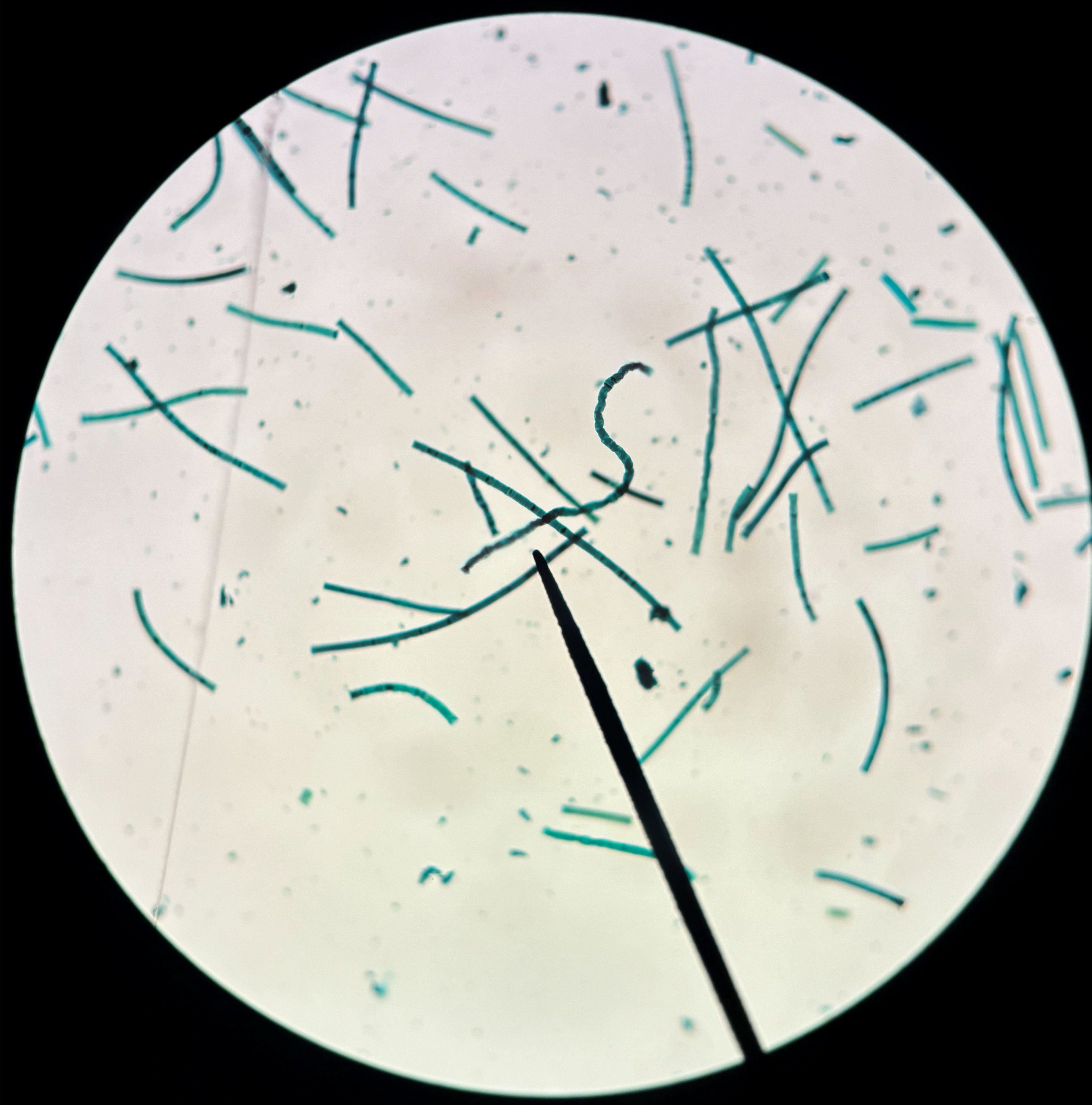 <p>What shape is this bacteria?</p>