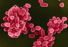 <p>-gram negative</p><p>-coccobacilli</p><p>-zoonotic</p>