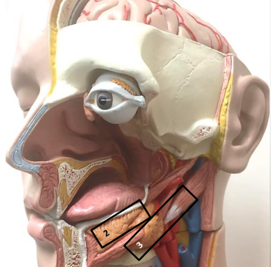 <p>Label this image.</p>
