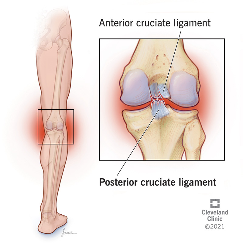 <p>What injury / condition? </p>