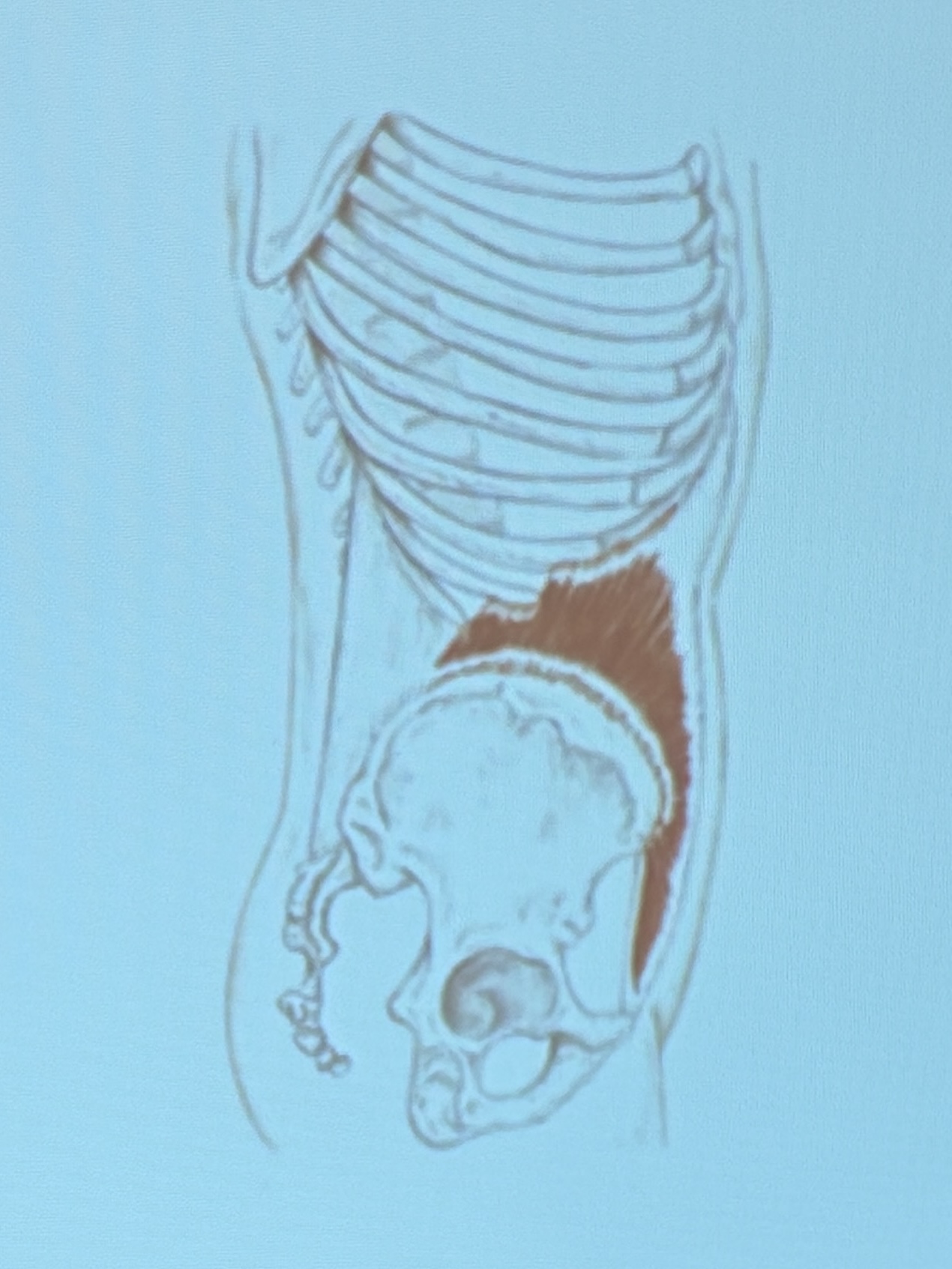 <p>Muscle name?</p>