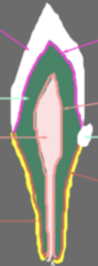 <p>What junction is does the red line portray</p>