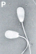 <p>What is this? Normal or abnormal sperm?</p>