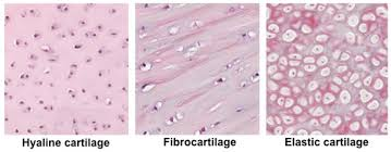 <ul><li><p>Fibrocartilage</p></li><li><p style="text-align: left;">Elastic cartilage</p></li><li><p style="text-align: left;">Hyaline cartilage</p></li></ul><p></p>