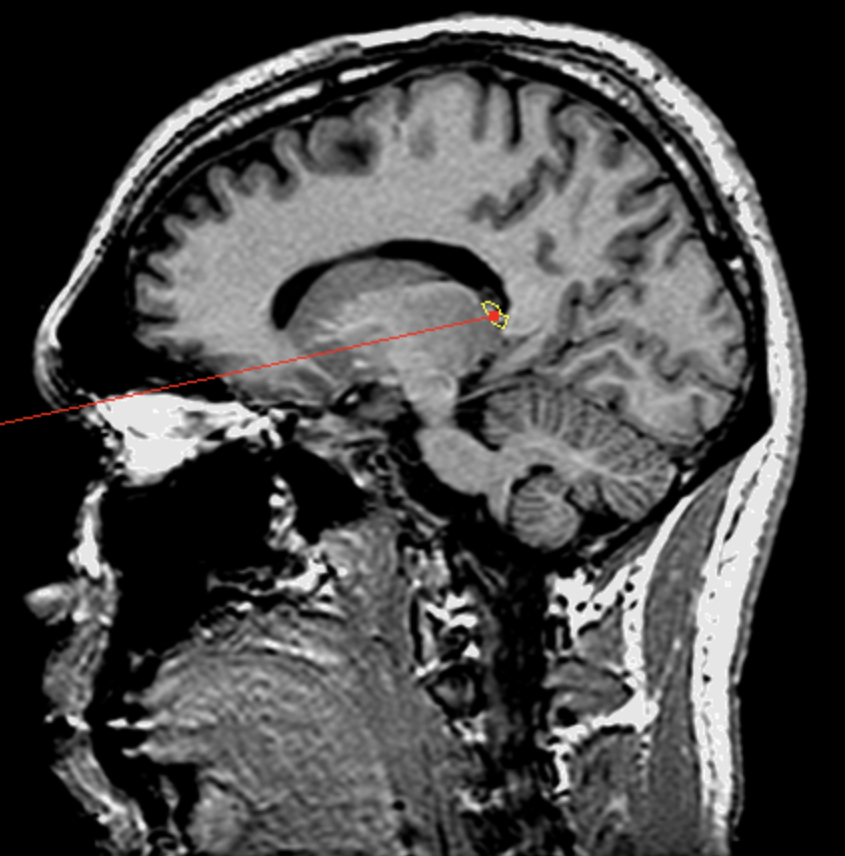 <p>What is the area highlighted called?</p>