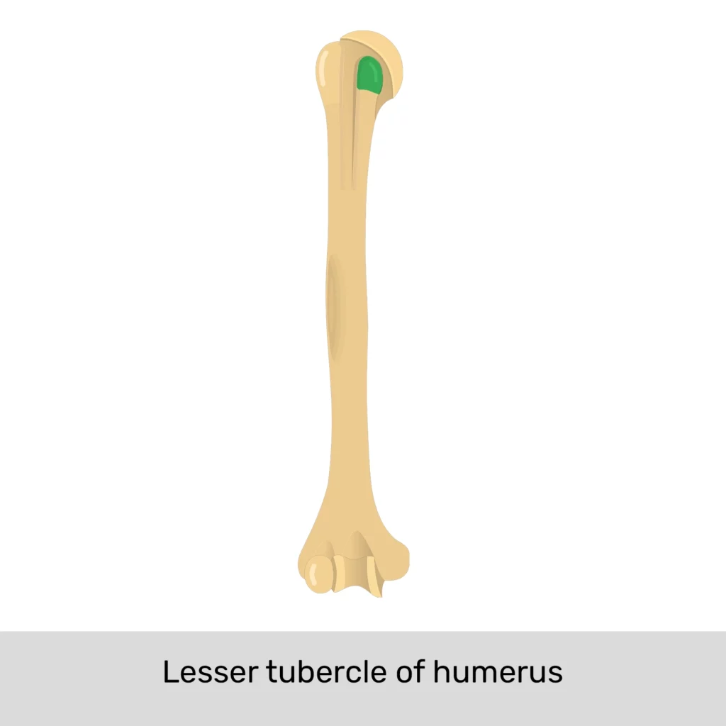 <p>Name the specific part of the bone in color</p>