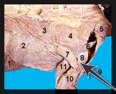 <p>muscle that works together with the spinodeltoid to raise and rotate the humerus</p>