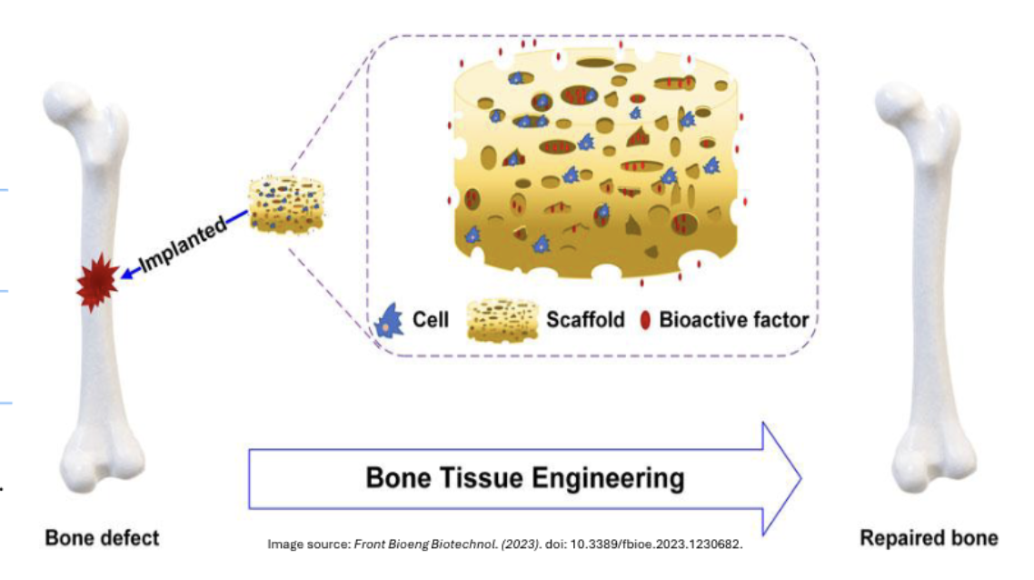 <ol><li><p>Cell Adhesion: Cells attach to scaffold surfaces through specific protein interactions </p></li><li><p>Proliferation: Rapid cell division increases cell population within the scaffold</p></li><li><p>Differentiation: Stem cells transform into specialized bone-forming osteoblasts </p></li><li><p>Matrix Formation: New bone tissue develops with proper mineral composition and structure </p></li></ol><p>Modern tissue engineering harnesses the natural power of bone cells, combining them with advanced biomaterials to regenerate lost bone tissue and restore function where traditional treatments fall short. </p><p></p>