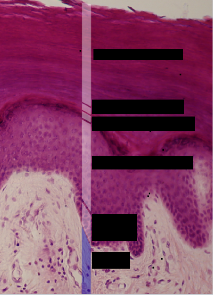 <p>Layers of the Epidermis </p>