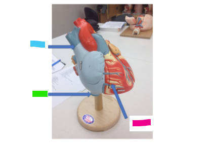 <p>What is the pink arrow?</p>