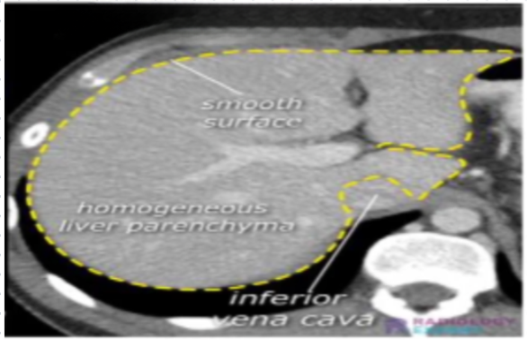 <p>diagnosis</p>