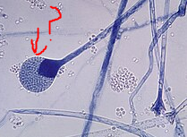 <p>What is this sac lookin thing</p>
