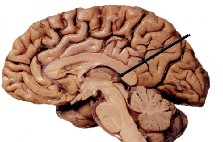 <p>Physiological role unclear, secretes melatonin (thought to help with internal clock/sleep cycles). </p>