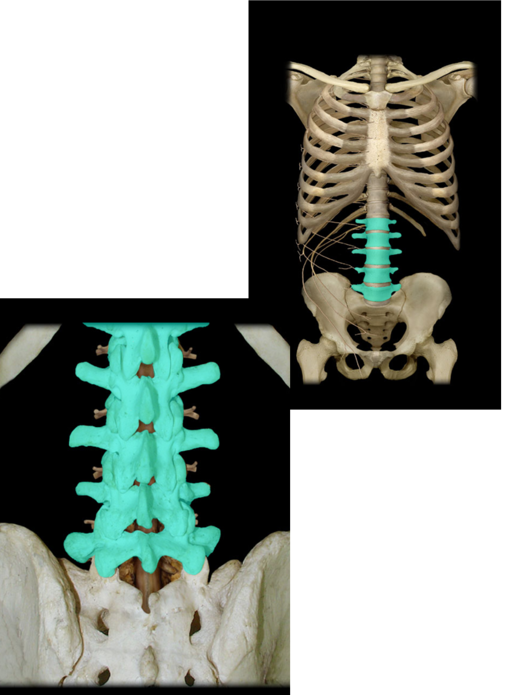 <p>Lumbar vertebra</p>