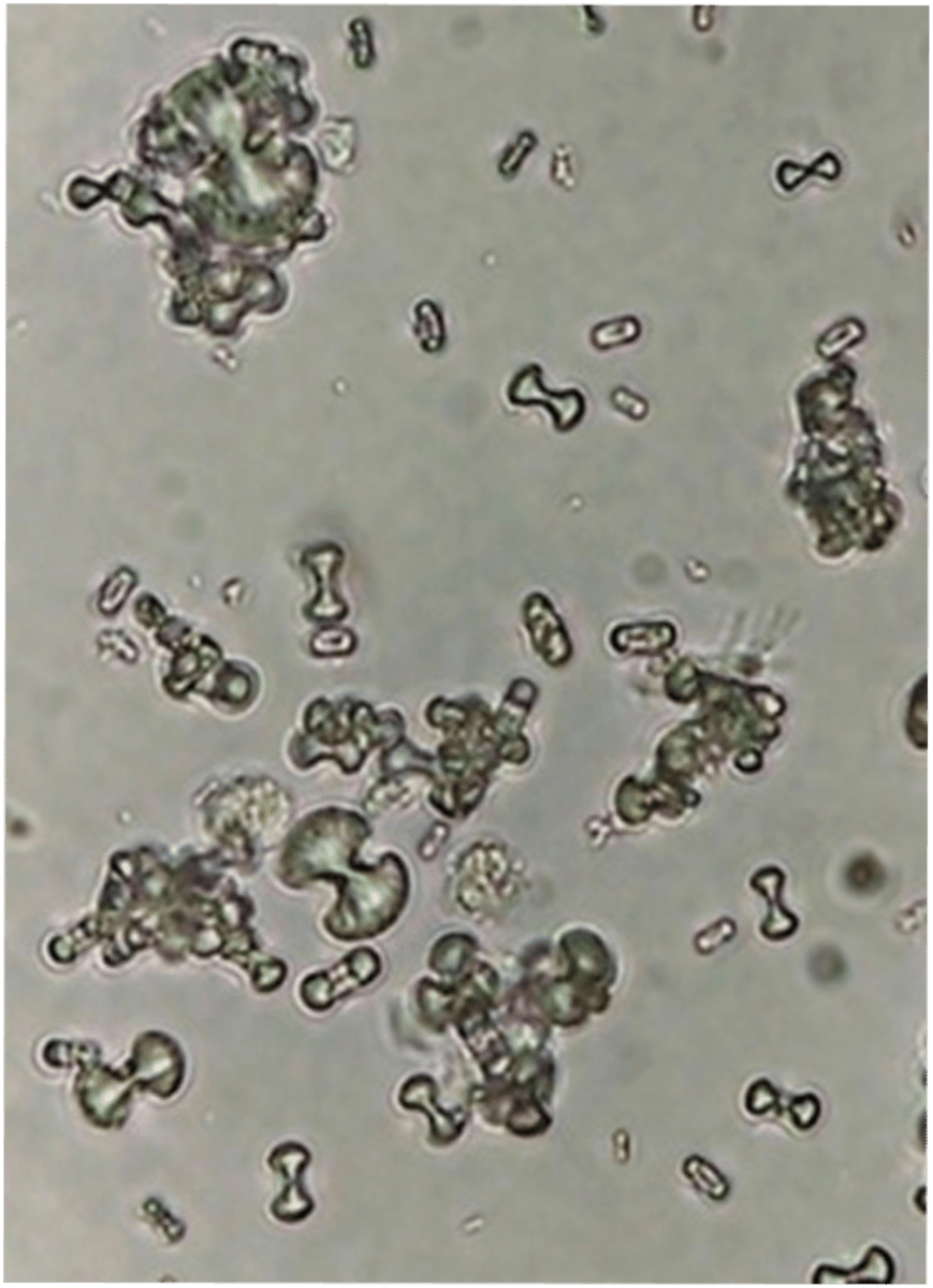 <p>pH >7.5</p>