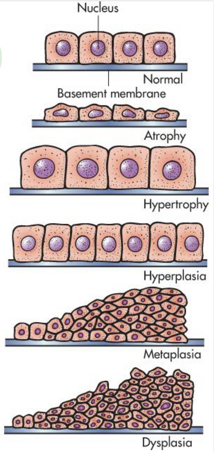 <p>Increase in cell number due to increased rate of cellular division (e.g., BPH, callus)</p>