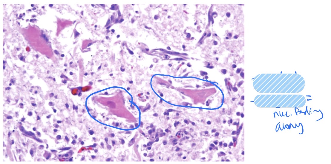 term image
