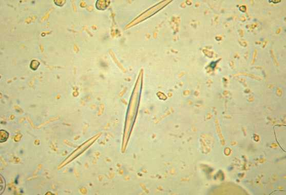<p>Parasite or Artifact? Identify.</p>