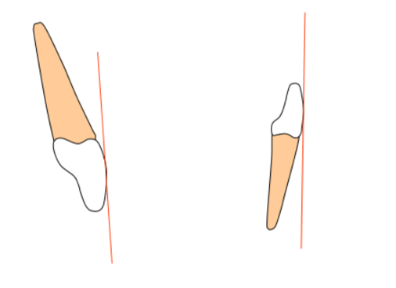 <p>incisor inclination avg degrees</p>