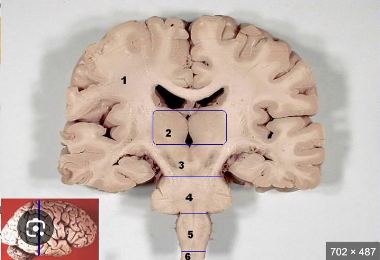 <p>Label 2, 3, 4, 5 and 6 (brain stem)</p>