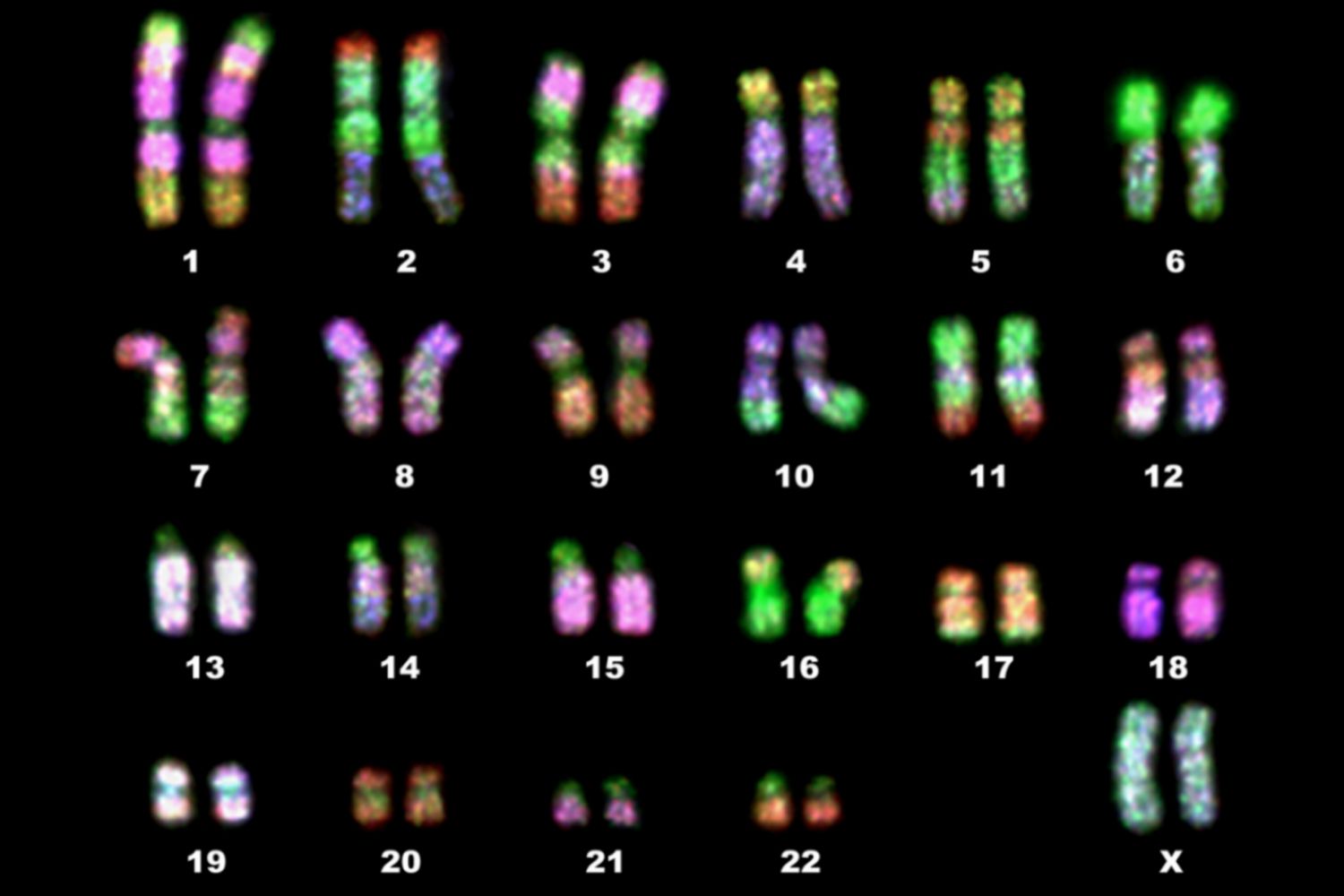 <p>This is a form of imagery that shows the complete ordered set of chromosomes</p>