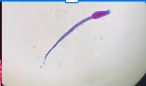 <p>What Subphylum, Phylum is this part of? What is it?</p>