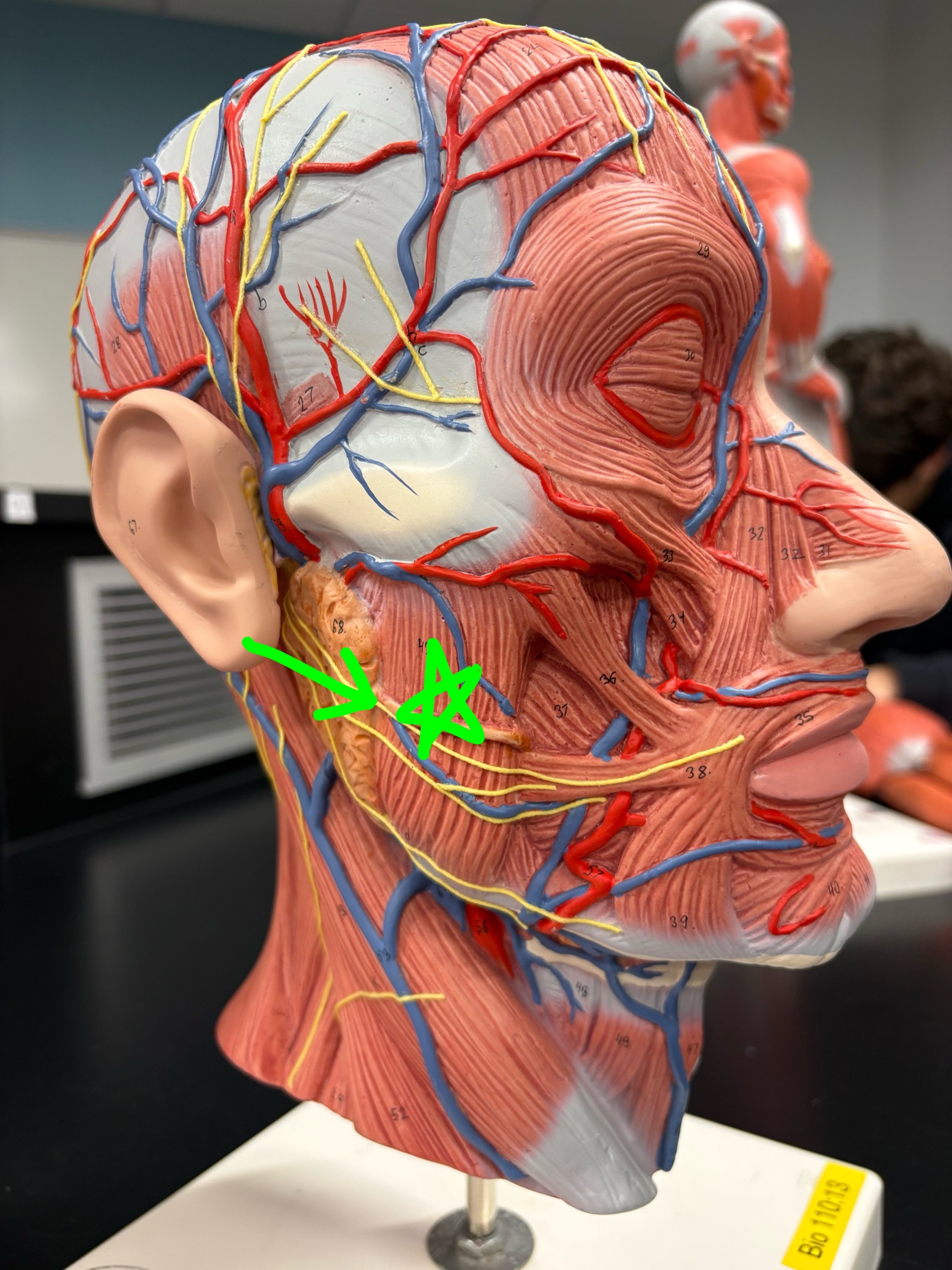 <p>Name the muscle.</p>