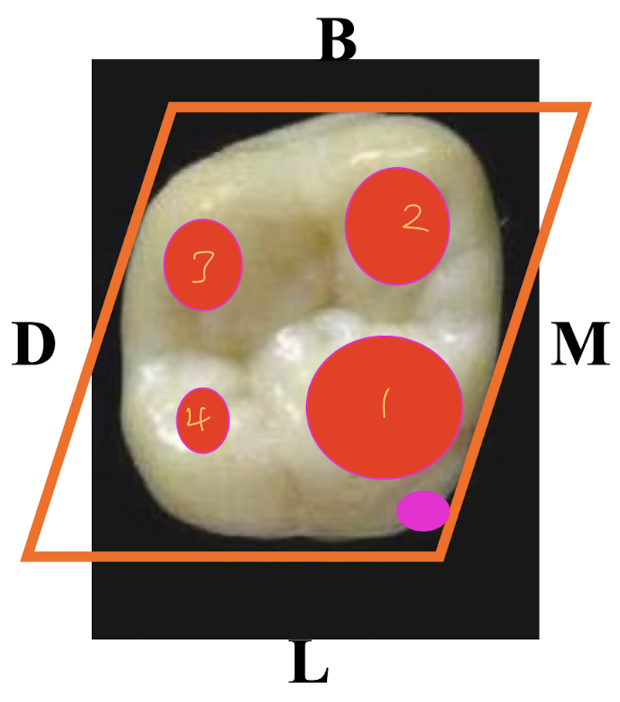 <ul><li><p>geometric outline: rhomboidal, reduces in MD width from 1st to 3rd molar</p></li></ul><p>cusp size largest → smallest</p><ol><li><p>ML cusp</p></li><li><p>rounded MB</p></li><li><p>sharp DB</p></li><li><p>small distolingual</p></li><li><p><span style="color: rgb(255, 0, 201);">tubercle of Carabelli </span></p></li></ol><p></p>