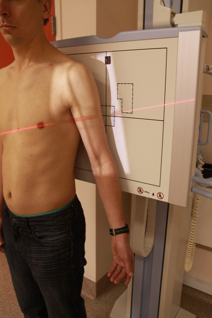 <p>erect with back against the erect bucky </p>