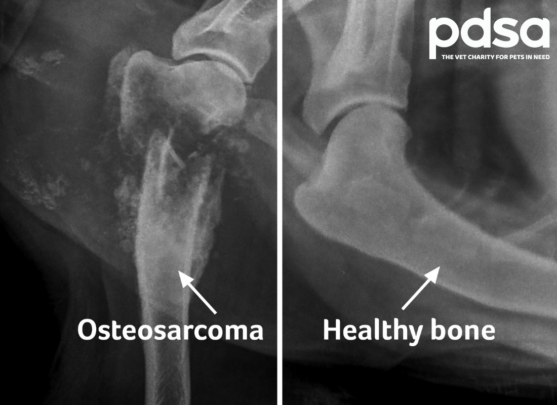 <p>Osteosarcoma (ALP significance)</p>