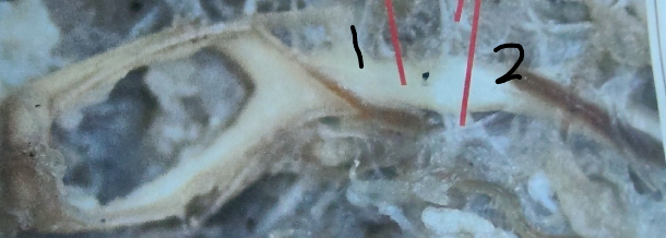 <p>What is point 2 on this earthworm</p>