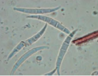 <p>Type of mold? </p>