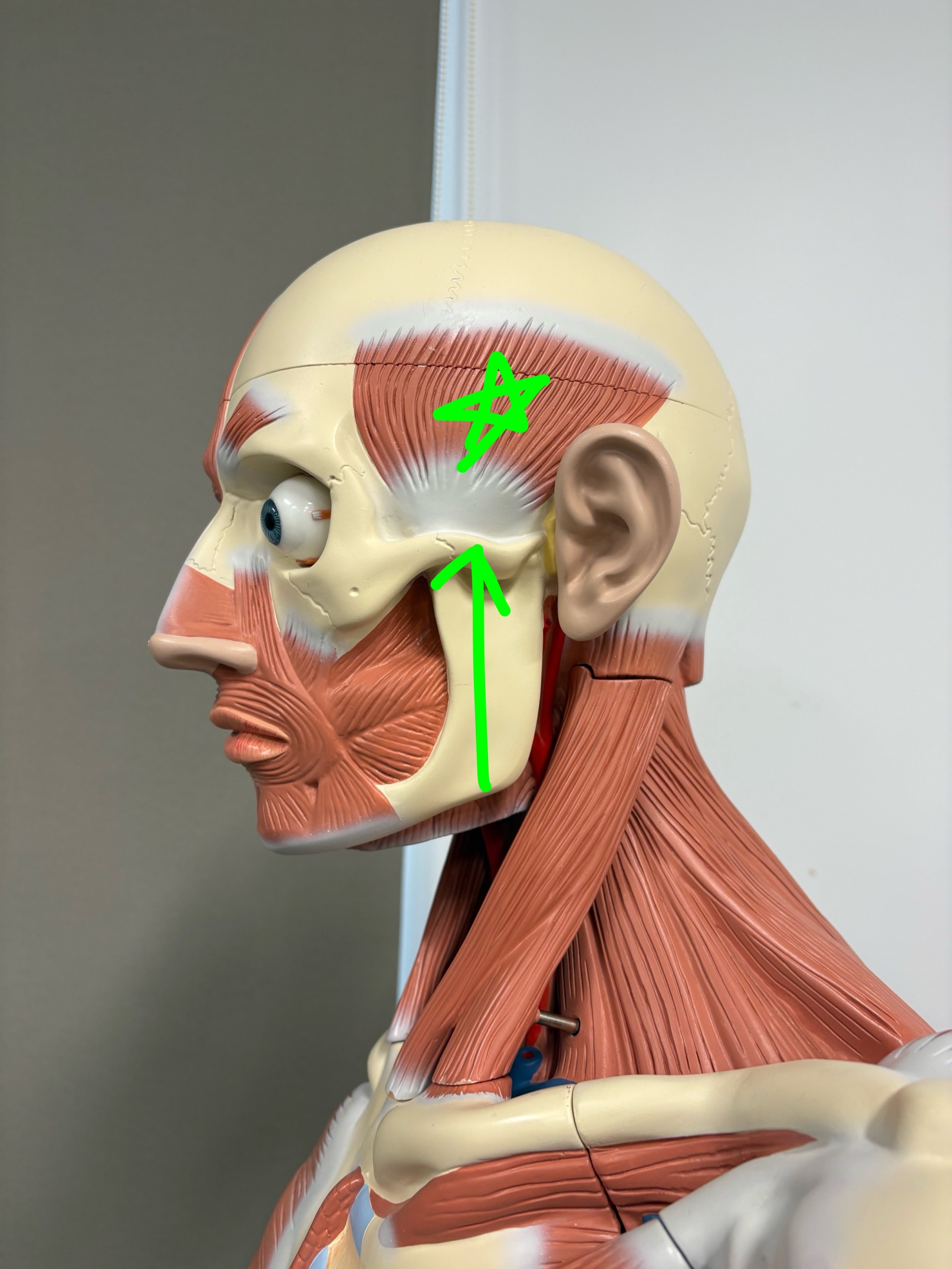 <p>Name the muscle.</p>