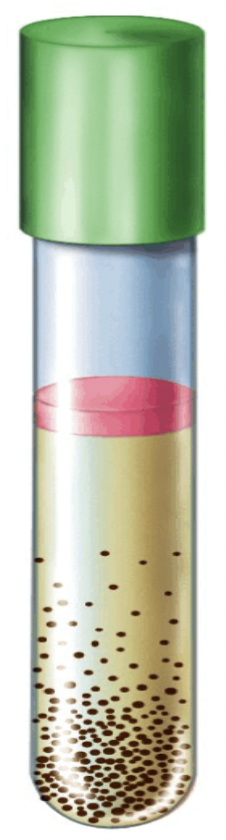 <p>Bacteria that are _______ _______ can only survive without oxygen because oxygen kills them. So they will only grow at the bottom of the tube.</p>