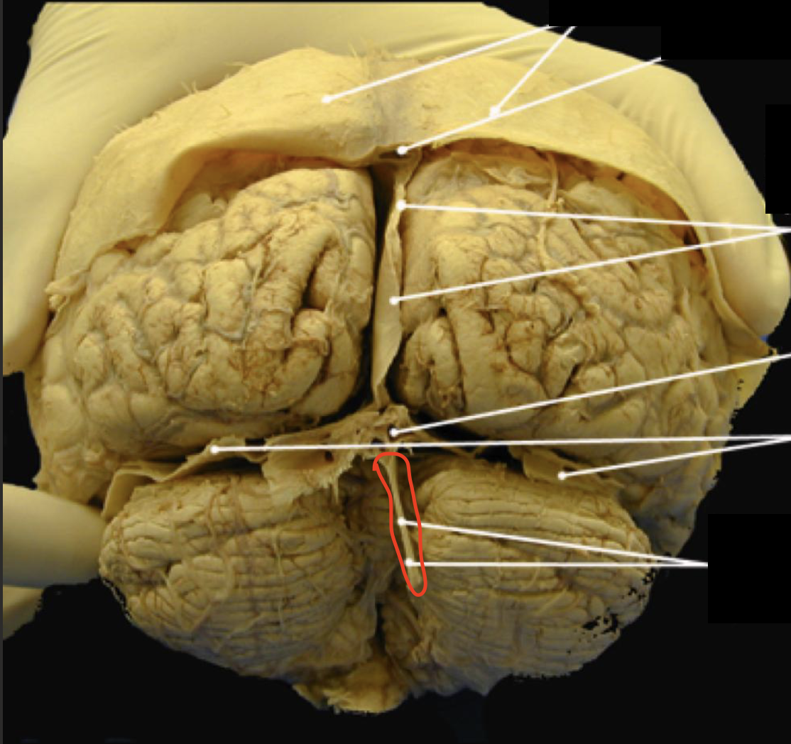 <p>seperates the right and left cerebellum </p>
