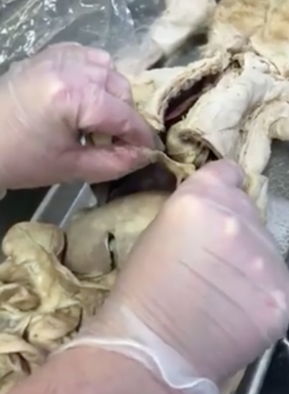 <p>what is the “flap” structure she is holding</p>