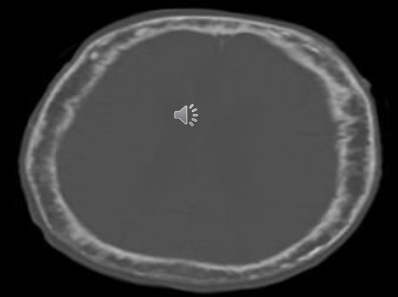 <p>What is the pathology?</p>