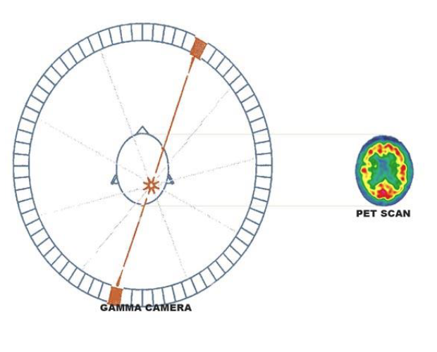 <p>positron emission tomography</p><ul><li><p>nuclear imaging that allows visualization of physiologic proceses in body </p></li><li><p>imaging, characterization, quantification of bio processes, stages → all happen at cellular and subcellular levels of living subjects </p></li></ul><p></p>