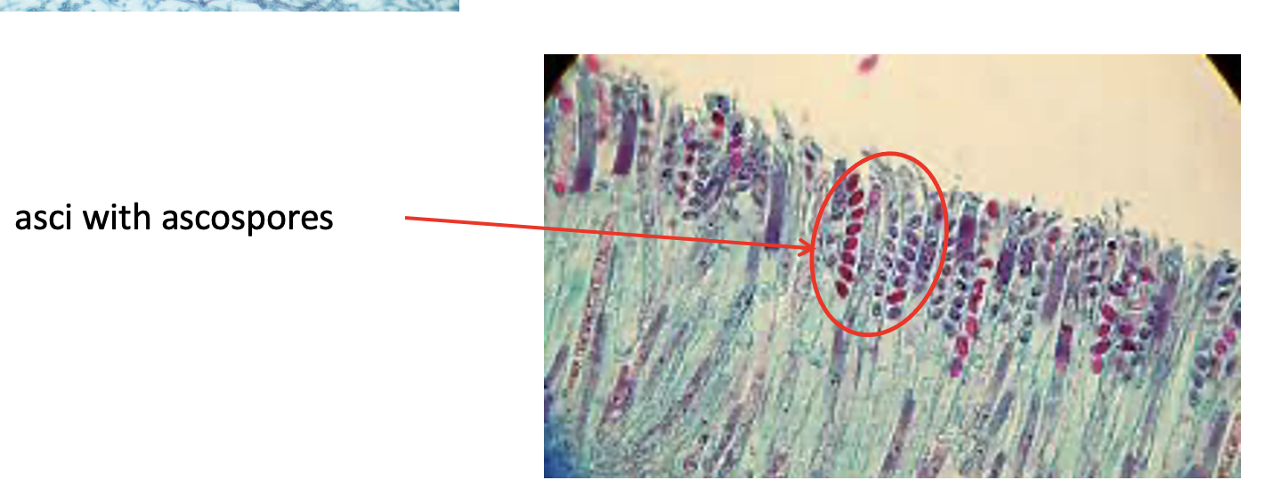 <p>A type of ascomycota</p><p>Also called “cup fungus”</p><p>The large blue cylinders are <strong>ascus</strong> and filled with the pink <strong>ascospores</strong> </p>