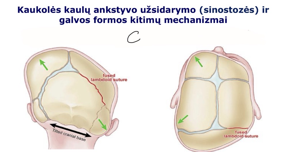 <p>C</p>